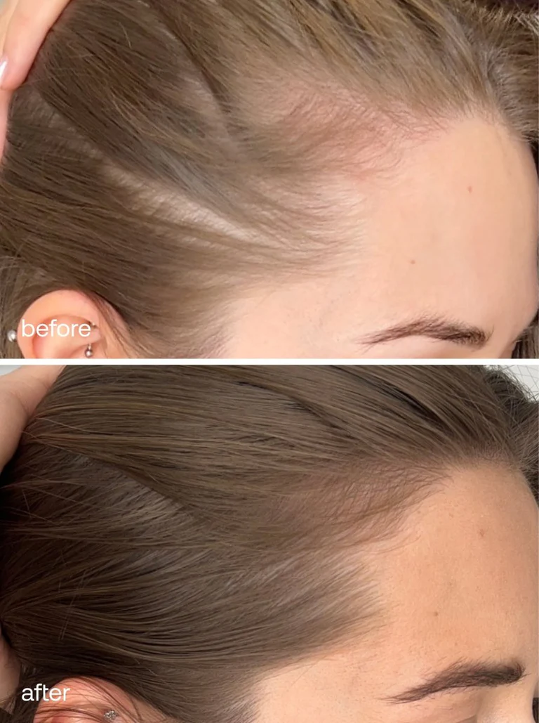 Ukhair Advanced Hair Supplements - Image 6
